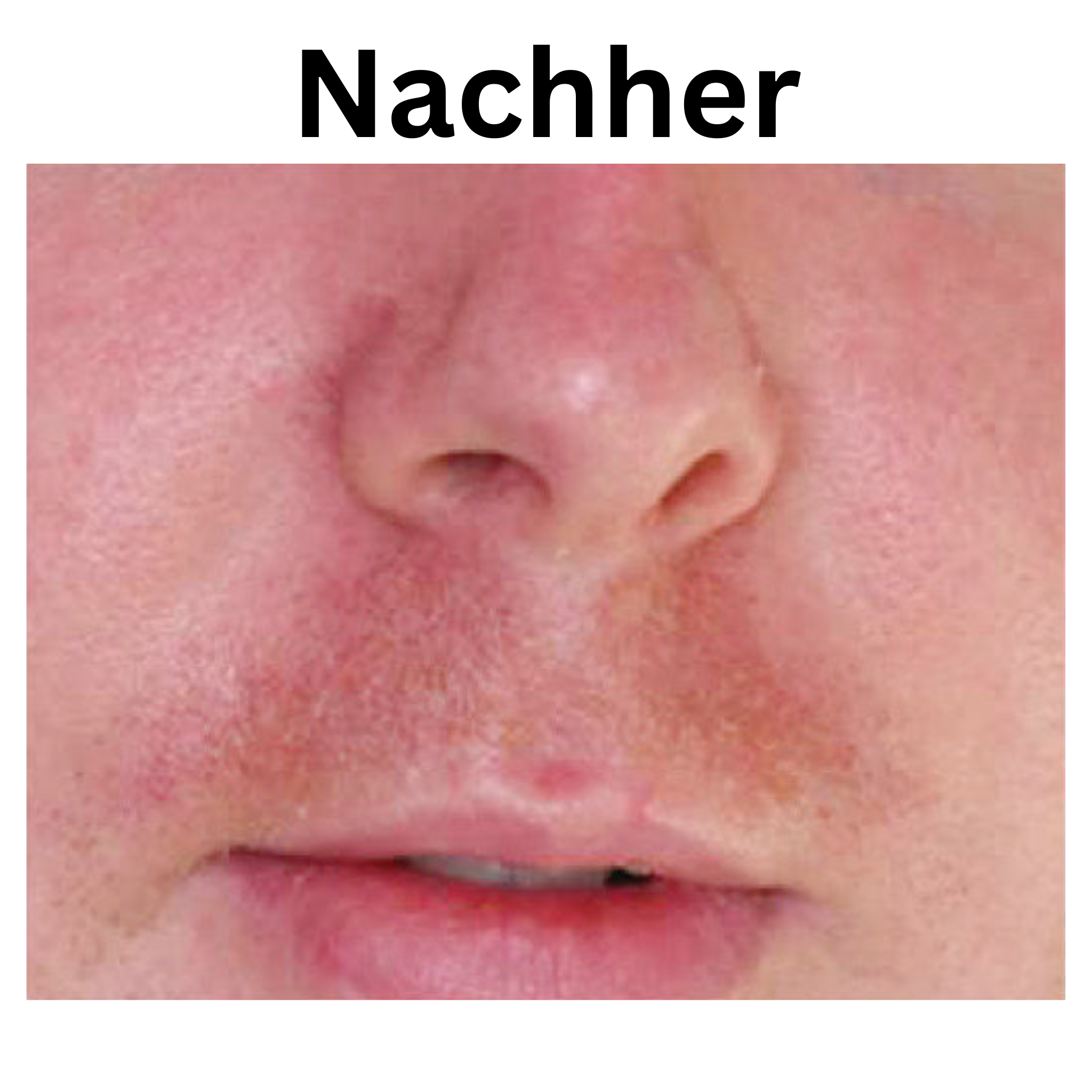iS Clinical Vorher Nachher Bild Pro heal Advance +