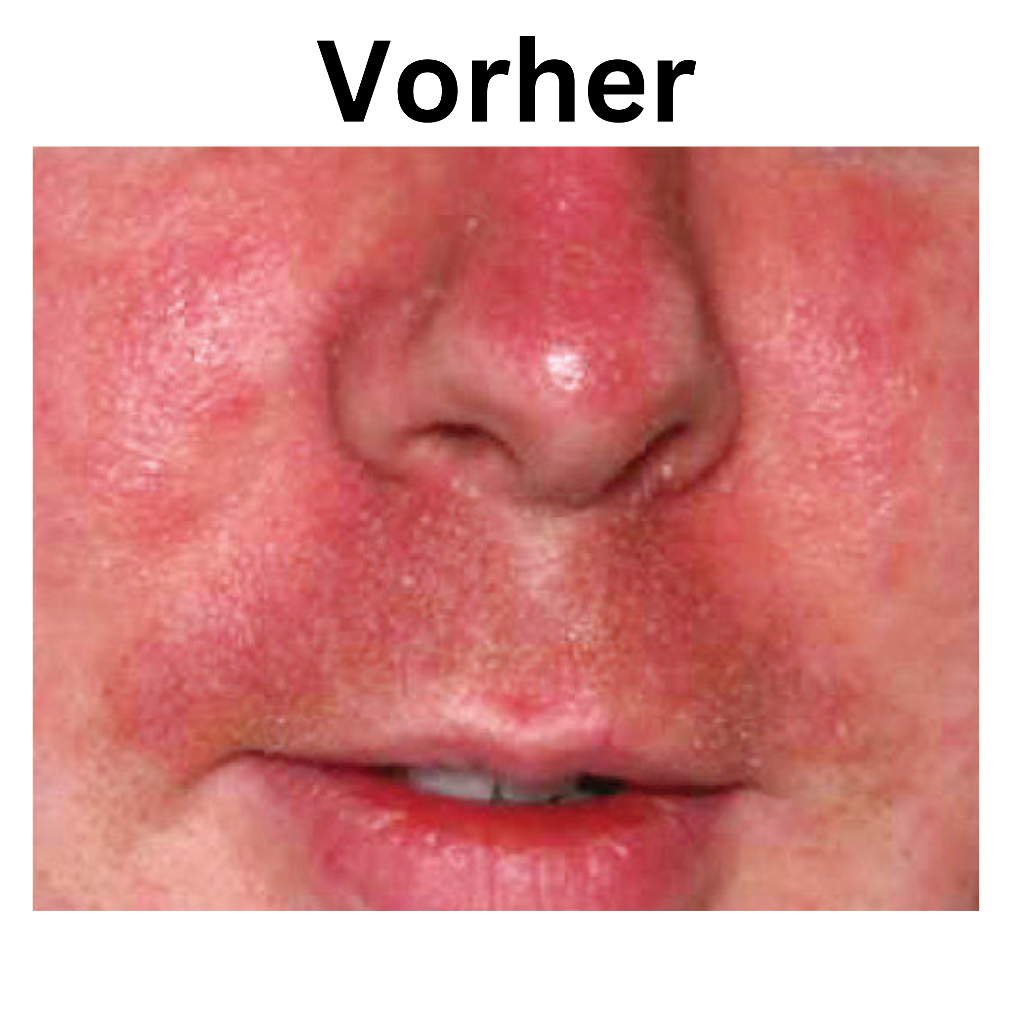 iS Clinical Vorher Nachher Bild Pro heal Advance +